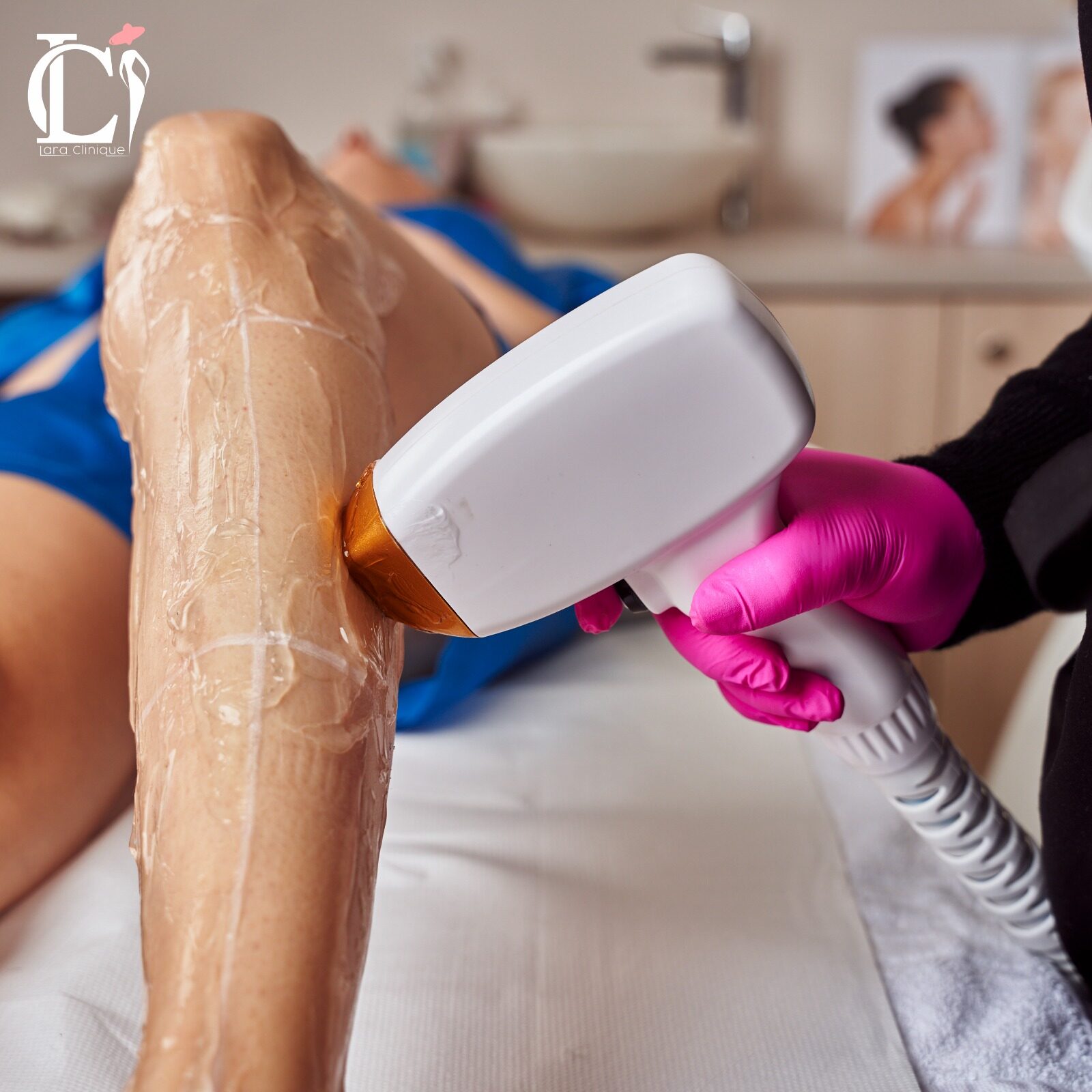 Laser Diodă + Alexandrite